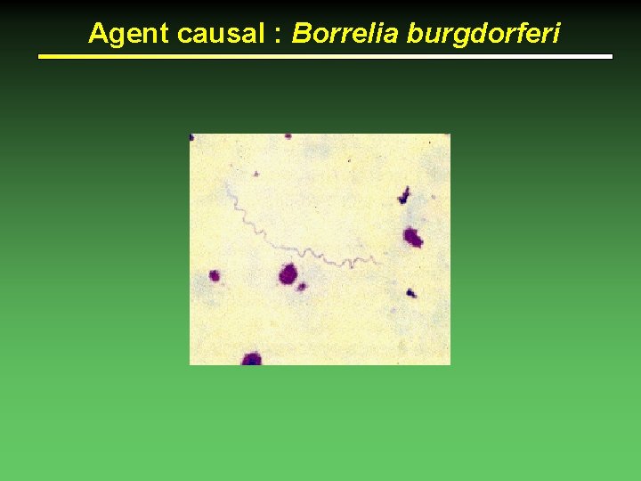 Agent causal : Borrelia burgdorferi 