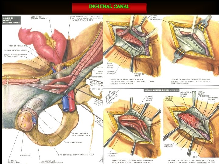 INGUINAL CANAL 