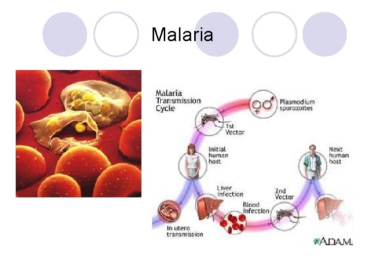 Malaria 