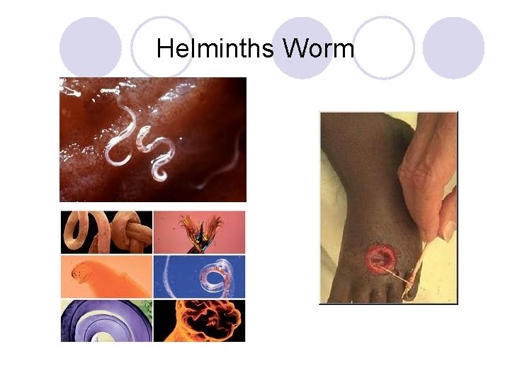 Helminths Worm 