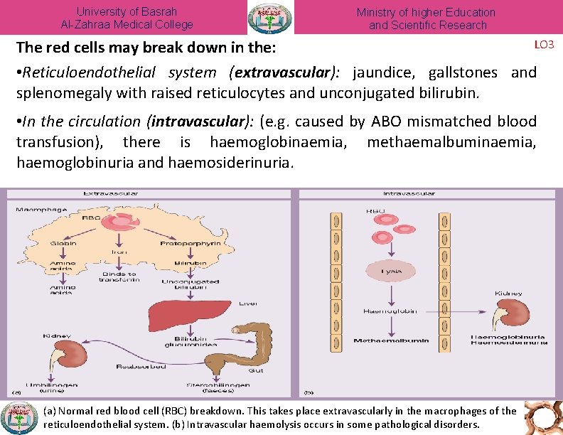 University of Basrah Al-Zahraa Medical College Ministry of higher Education and Scientific Research LO
