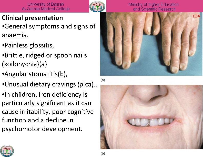 University of Basrah Al-Zahraa Medical College Clinical presentation • General symptoms and signs of