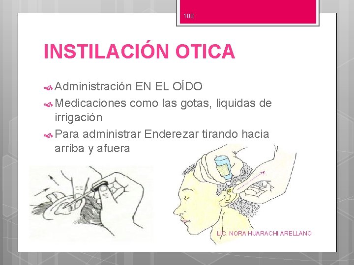 100 INSTILACIÓN OTICA Administración EN EL OÍDO Medicaciones como las gotas, liquidas de irrigación