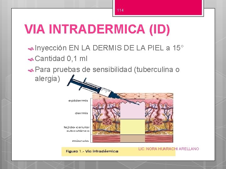 114 VIA INTRADERMICA (ID) Inyección EN LA DERMIS DE LA PIEL a 15° Cantidad