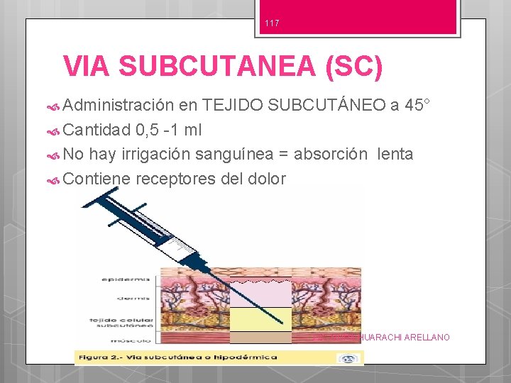 117 VIA SUBCUTANEA (SC) Administración en TEJIDO SUBCUTÁNEO a 45° Cantidad 0, 5 -1