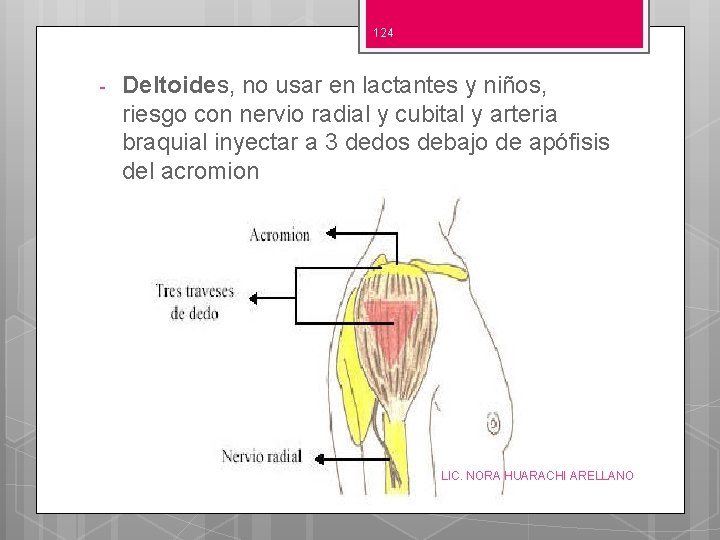 124 - Deltoides, no usar en lactantes y niños, riesgo con nervio radial y