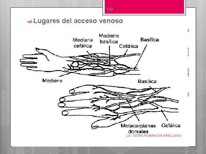 133 Lugares del acceso venoso LIC. NORA HUARACHI ARELLANO 