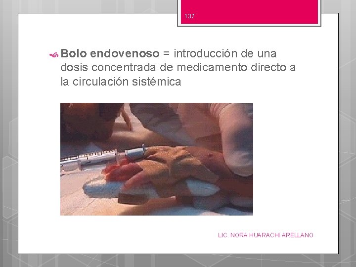 137 Bolo endovenoso = introducción de una dosis concentrada de medicamento directo a la