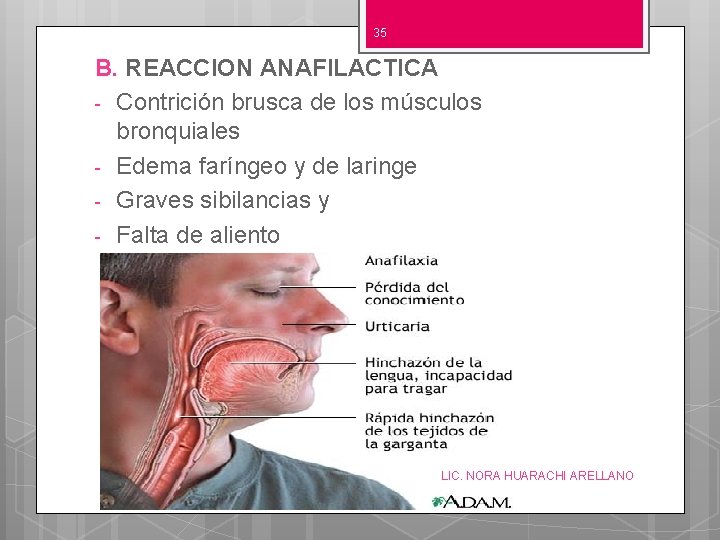 35 B. REACCION ANAFILACTICA - Contrición brusca de los músculos bronquiales - Edema faríngeo