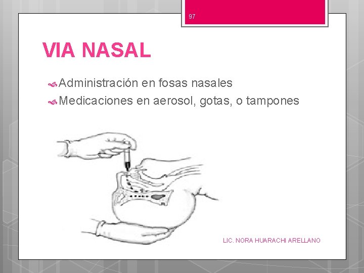 97 VIA NASAL Administración en fosas nasales Medicaciones en aerosol, gotas, o tampones LIC.