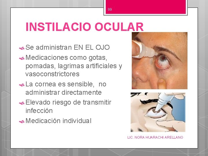 99 INSTILACIO OCULAR Se administran EN EL OJO Medicaciones como gotas, pomadas, lagrimas artificiales