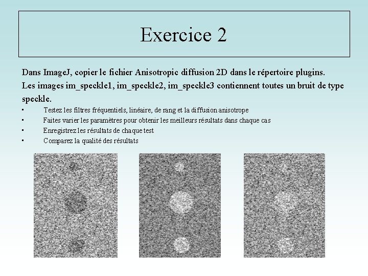 Exercice 2 Dans Image. J, copier le fichier Anisotropic diffusion 2 D dans le