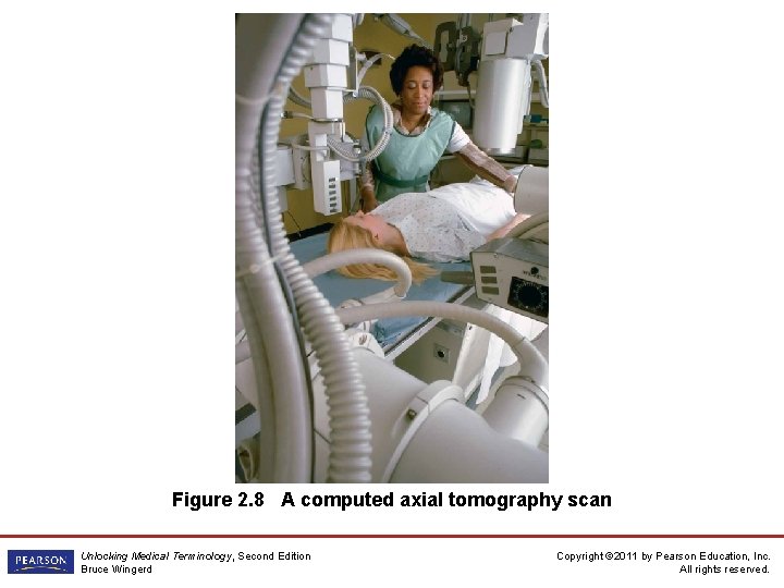 Figure 2. 8 A computed axial tomography scan Unlocking Medical Terminology, Second Edition Bruce