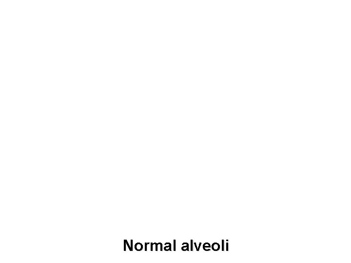 Normal alveoli 