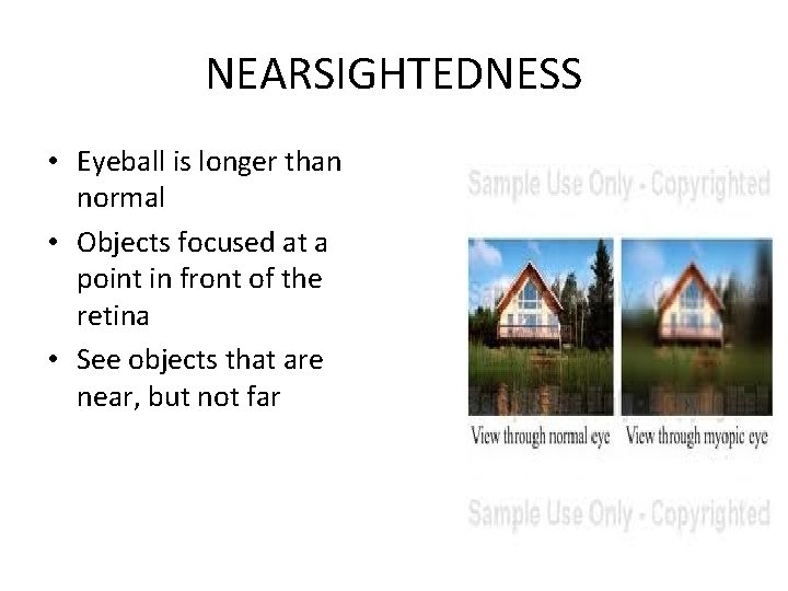 NEARSIGHTEDNESS • Eyeball is longer than normal • Objects focused at a point in