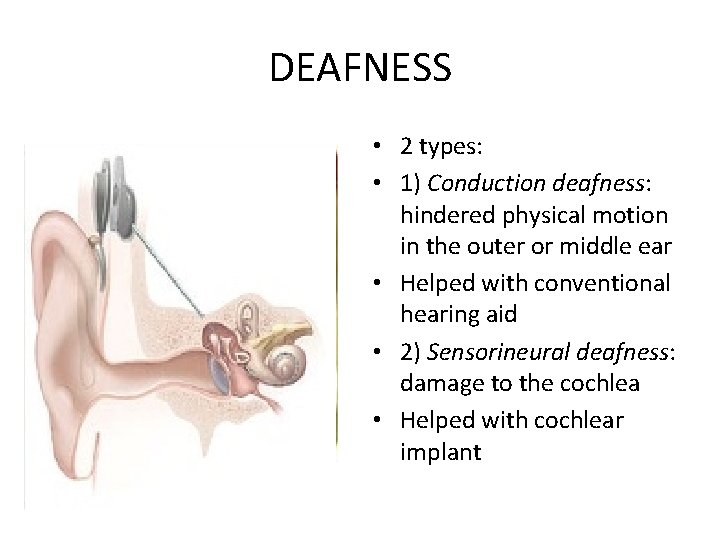 DEAFNESS • 2 types: • 1) Conduction deafness: hindered physical motion in the outer