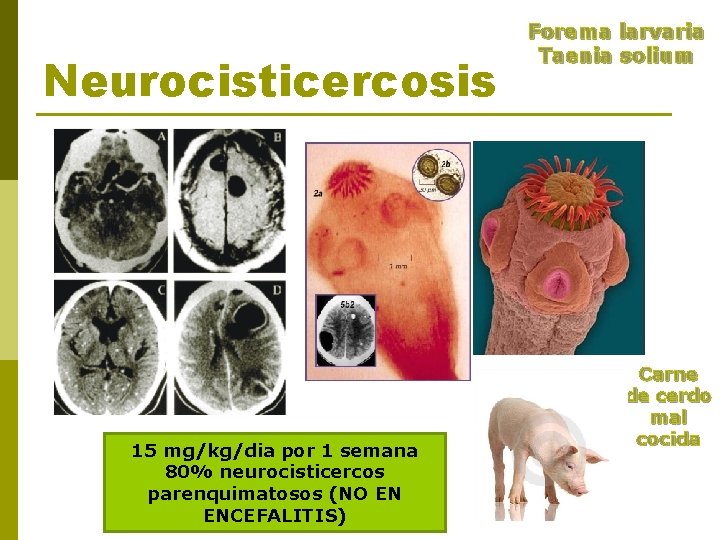 Neurocisticercosis 15 mg/kg/dia por 1 semana 80% neurocisticercos parenquimatosos (NO EN ENCEFALITIS) Forema larvaria