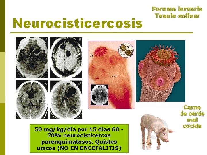 Neurocisticercosis 50 mg/kg/dia por 15 dias 60 70% neurocisticercos parenquimatosos. Quistes unicos (NO EN