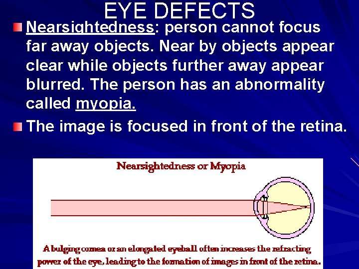 EYE DEFECTS Nearsightedness: person cannot focus far away objects. Near by objects appear clear