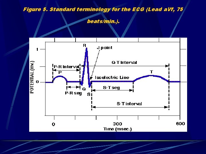 Figure 5. Standard terminology for the ECG (Lead a. Vf, 75 beats/min. ). 