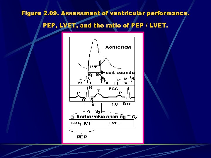 Figure 2. 09. Assessment of ventricular performance. PEP, LVET, and the ratio of PEP