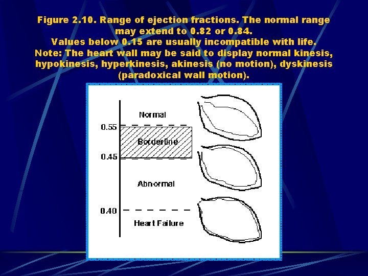 Figure 2. 10. Range of ejection fractions. The normal range may extend to 0.