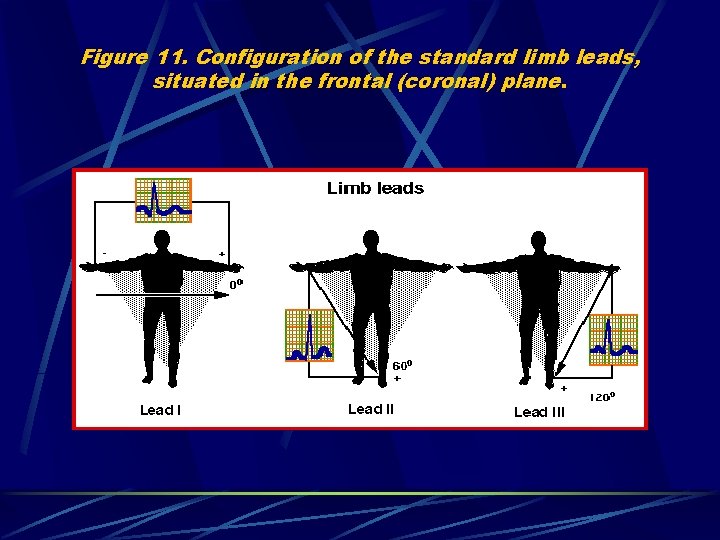 Figure 11. Configuration of the standard limb leads, situated in the frontal (coronal) plane.