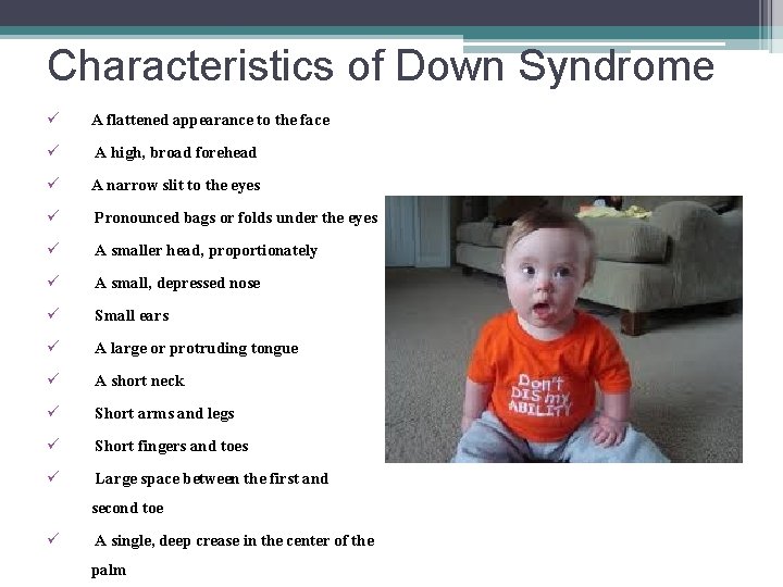 Characteristics of Down Syndrome ü A flattened appearance to the face ü A high,