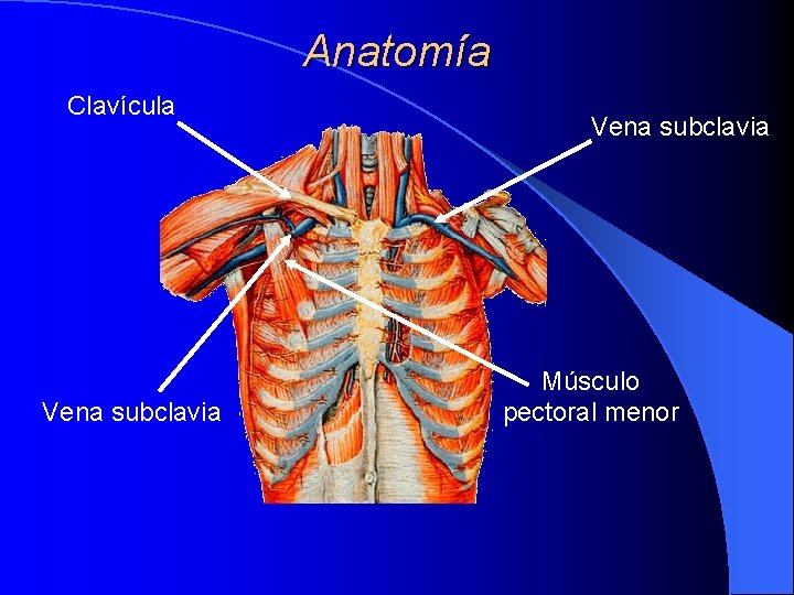 Anatomía Clavícula Vena subclavia Músculo pectoral menor Anatomía Clavícula Vena subclavia Músculo pectoral menor