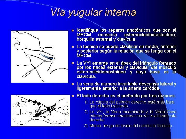 Vía yugular interna Identifique los reparos anatómicos que son el MECM (músculo esternocleidomastoideo), horquilla Vía yugular interna Identifique los reparos anatómicos que son el MECM (músculo esternocleidomastoideo), horquilla