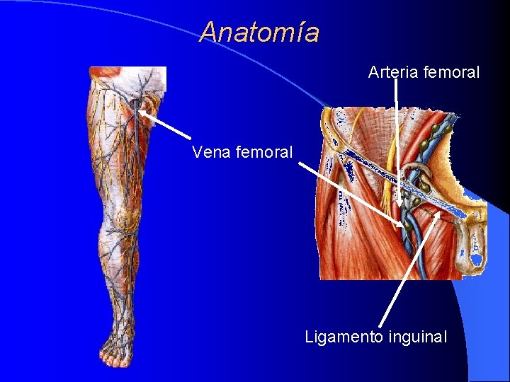 Anatomía Arteria femoral Vena femoral Músculo pectoral menor Ligamento inguinal Anatomía Arteria femoral Vena femoral Músculo pectoral menor Ligamento inguinal