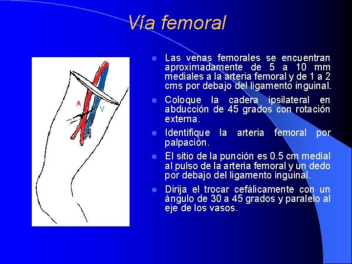 Vía femoral l l Las venas femorales se encuentran aproximadamente de 5 a 10 Vía femoral l l Las venas femorales se encuentran aproximadamente de 5 a 10