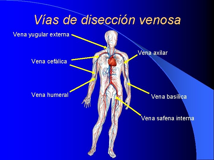 Vías de disección venosa Vena yugular externa Vena axilar Vena cefálica Vena humeral Vena Vías de disección venosa Vena yugular externa Vena axilar Vena cefálica Vena humeral Vena