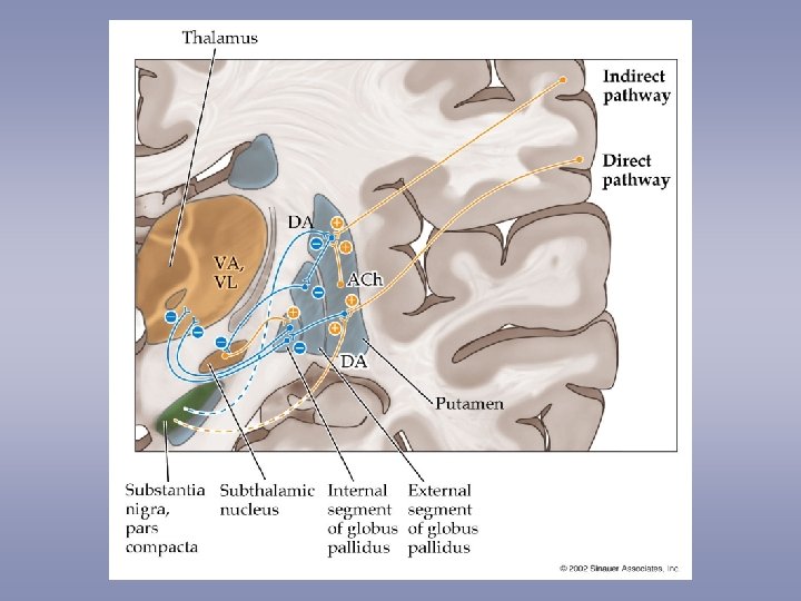 CASE III3 RightSided Tremor Rigidity Slowness and Gait
