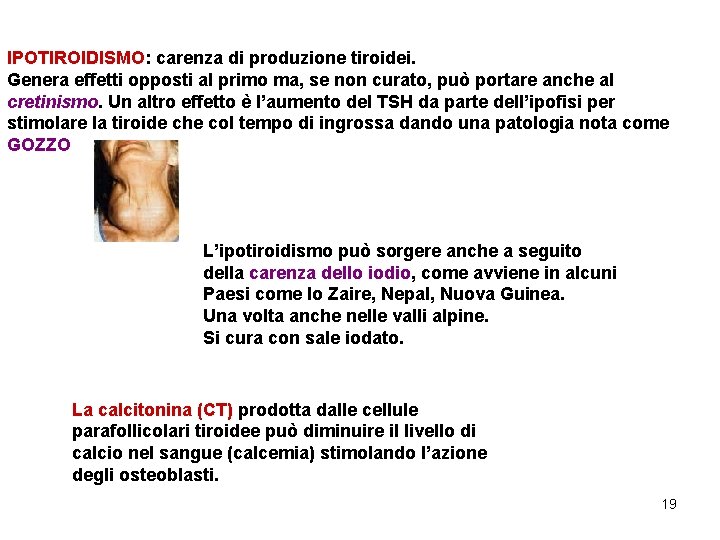 IPOTIROIDISMO: carenza di produzione tiroidei. Genera effetti opposti al primo ma, se non curato,