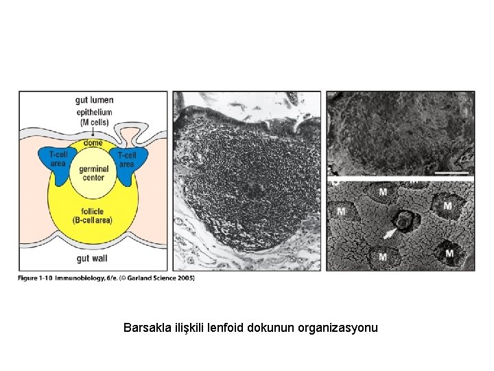 Figure 1 -10 Barsakla ilişkili lenfoid dokunun organizasyonu 