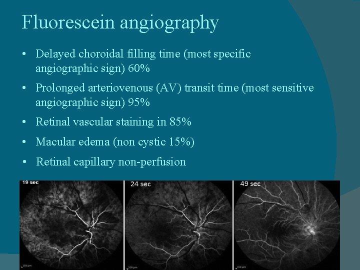Fluorescein angiography • Delayed choroidal filling time (most specific angiographic sign) 60% • Prolonged