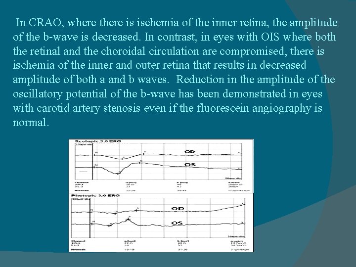 In CRAO, where there is ischemia of the inner retina, the amplitude of the
