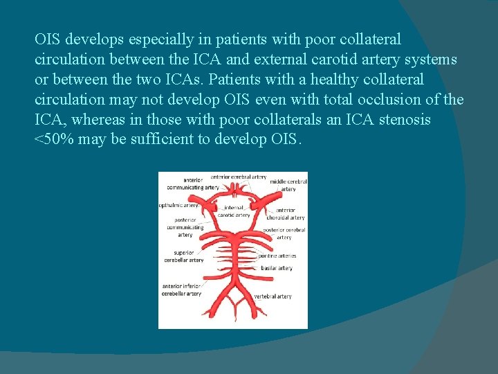 OIS develops especially in patients with poor collateral circulation between the ICA and external