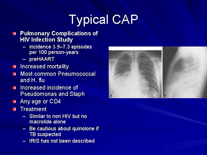 Typical CAP Pulmonary Complications of HIV Infection Study – incidence 3. 9– 7. 3