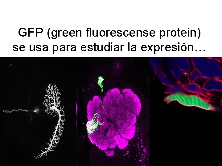 GFP (green fluorescense protein) se usa para estudiar la expresión… 
