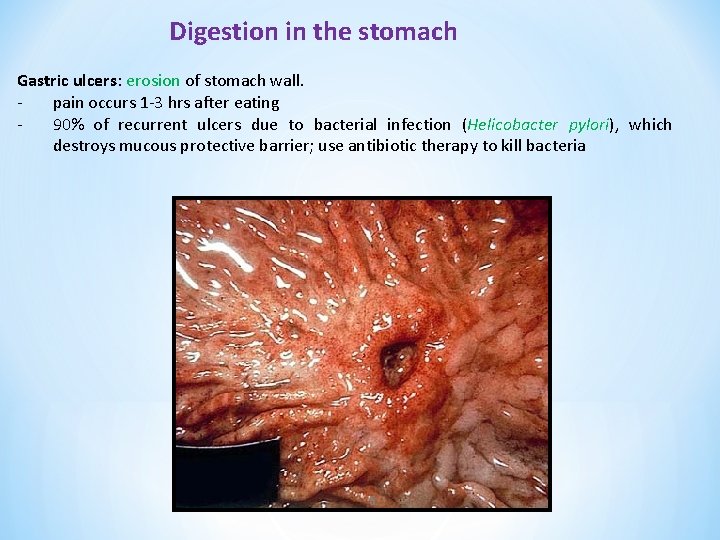 Digestion in the stomach Gastric ulcers: erosion of stomach wall. pain occurs 1 -3