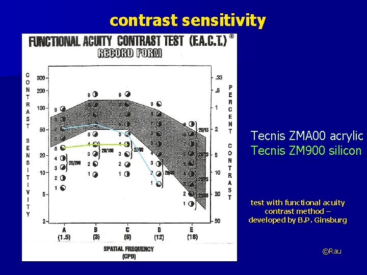 contrast sensitivity Tecnis ZMA 00 acrylic Tecnis ZM 900 silicon test with functional acuity