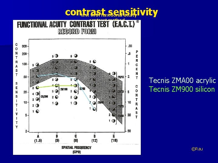 contrast sensitivity test with functional acuity contrast method – developed by B. P. Ginsburg