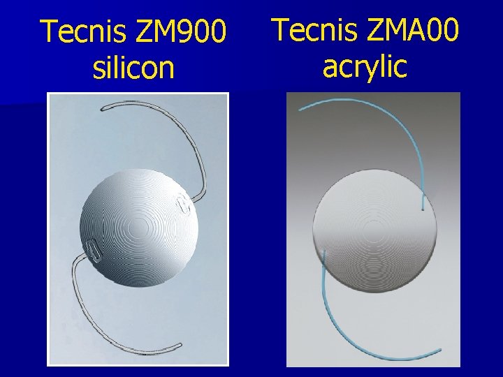 Tecnis ZM 900 silicon Tecnis ZMA 00 acrylic 