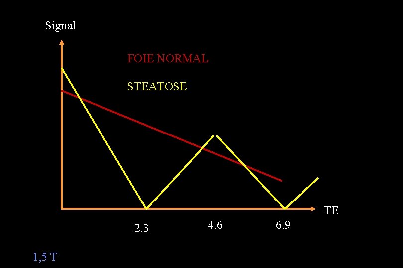 Signal FOIE NORMAL STEATOSE TE 2. 3 1, 5 T 4. 6 6. 9