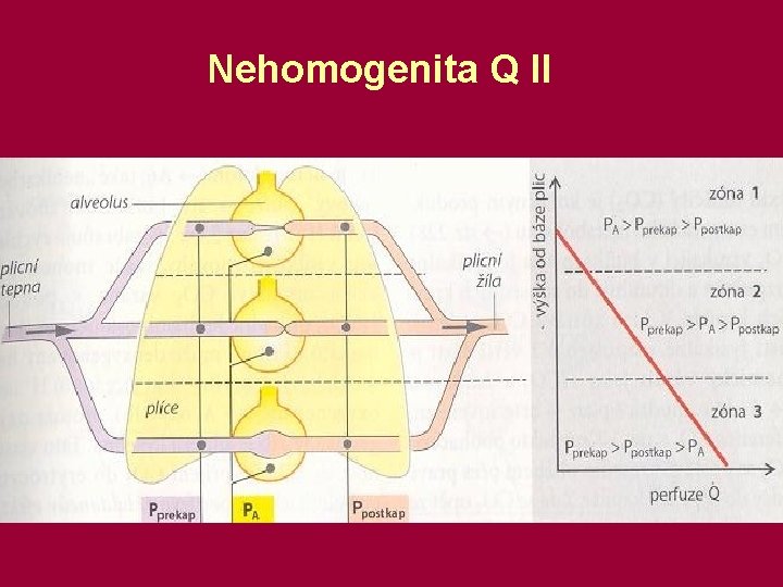 Nehomogenita Q II 