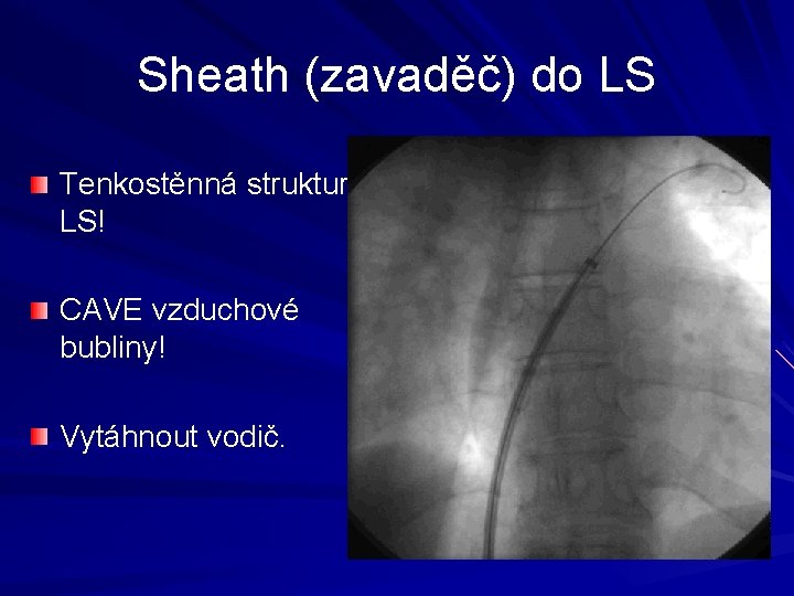 Sheath (zavaděč) do LS Tenkostěnná struktura LS! CAVE vzduchové bubliny! Vytáhnout vodič. 