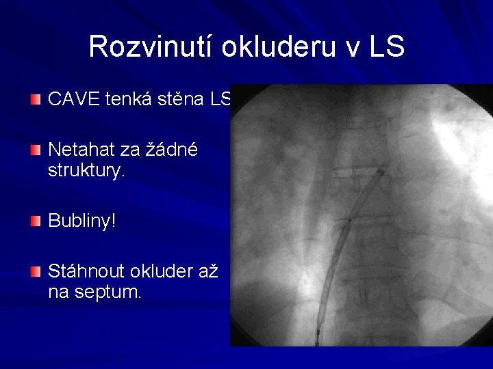 Rozvinutí okluderu v LS CAVE tenká stěna LS! Netahat za žádné struktury. Bubliny! Stáhnout