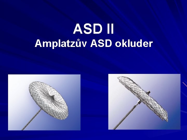 ASD II Amplatzův ASD okluder 
